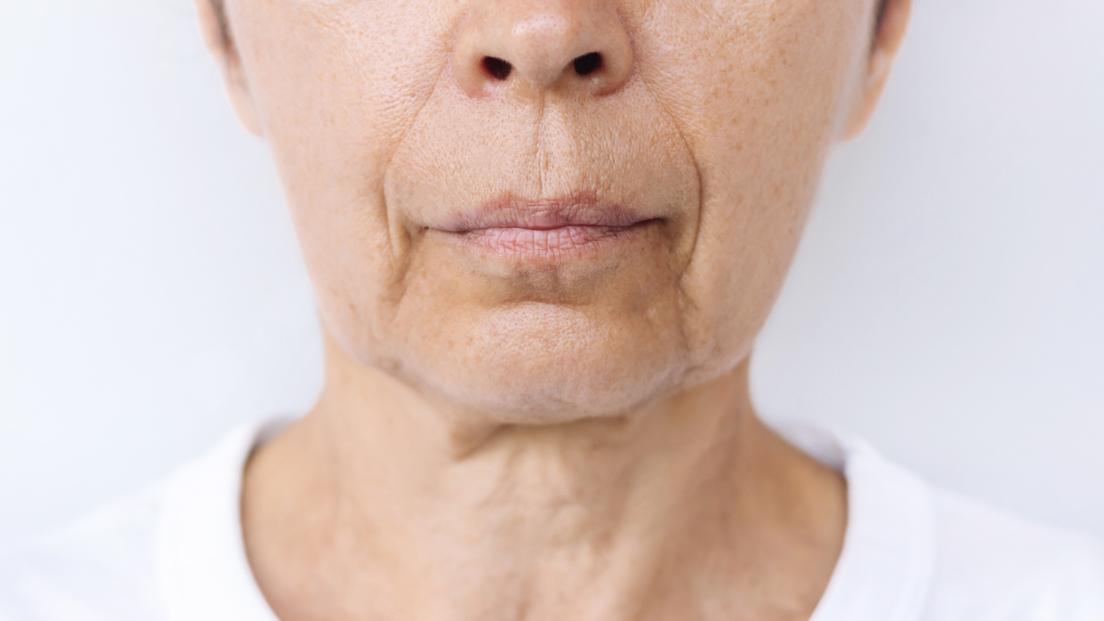 Flacidez no rosto: Quais cuidados de skincare podem ajudar?