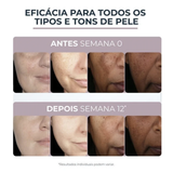 Eucerin Anti-Pigment Creme Facial Dia FPS 30